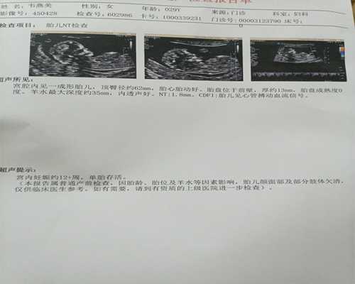 上海美国代孕网站,试管中介公司！上海哪些医院是值得信赖的？